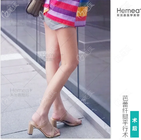北京禾美嘉任學會腿型矯正<span style=