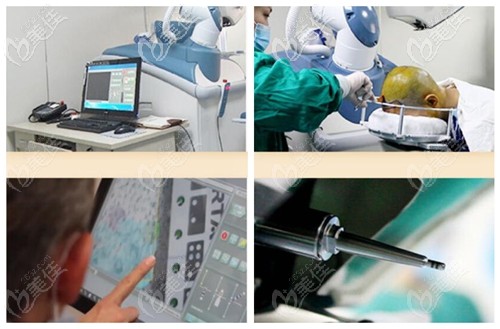 artas機(jī)器人植發(fā)的操作過程及優(yōu)勢(shì) artas機(jī)器人植發(fā)的操作過程及優(yōu)勢(shì)