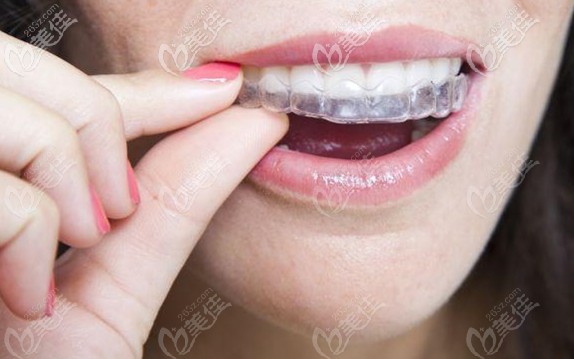 隱形牙套可以矯正地包天嗎