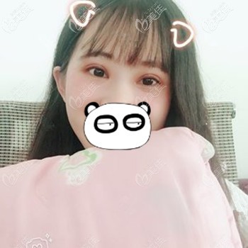 做眼綜合后上瞼下垂的情況得到了改善 做眼綜合后上瞼下垂的情況得到了改善