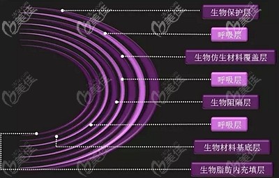 英各曼假體的不同層次
