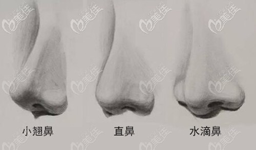 直鼻和小翹鼻的隆鼻區(qū)別 直鼻和小翹鼻的隆鼻區(qū)別