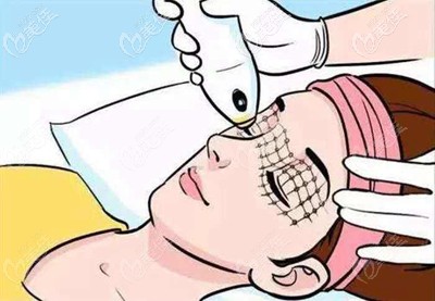 眼周熱瑪吉的部位