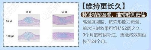 強(qiáng)度高維持時(shí)間就長(zhǎng) 強(qiáng)度高維持時(shí)間就長(zhǎng)