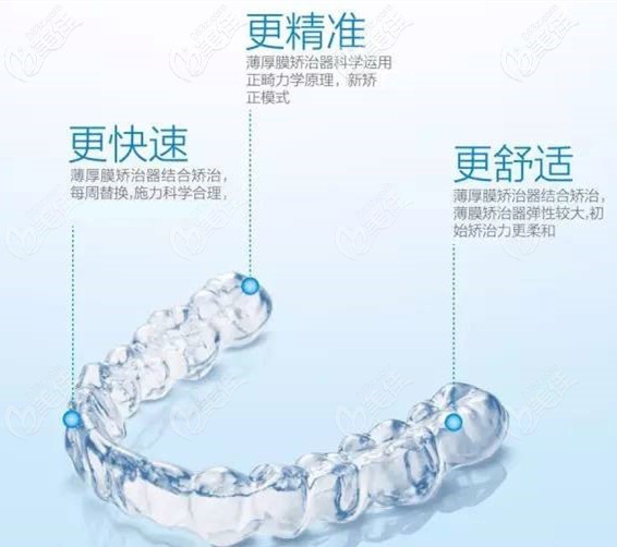 時代天使隱形矯正的特點