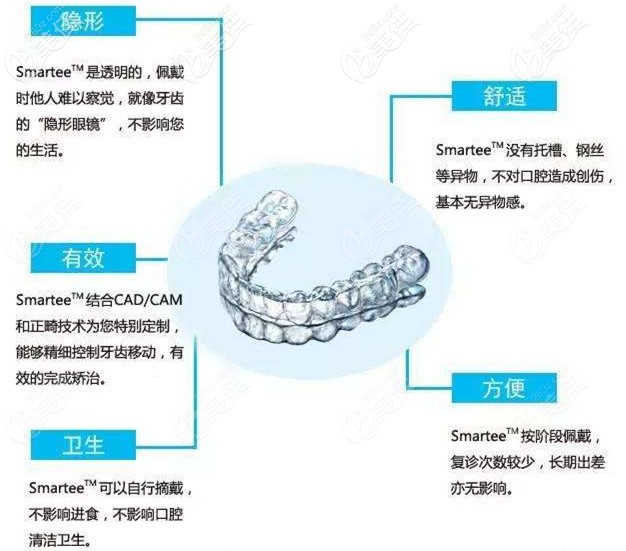 正雅（Smartee）隱形矯正特點