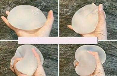 進(jìn)口隆胸假體牌子美國(guó)曼托和韓國(guó)蓓拉假體隆胸手感、價(jià)格比較