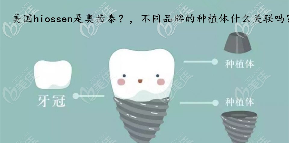 美國hiossen是奧齒泰嗎