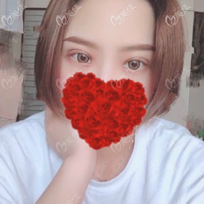 <!--<i data=20240703-sp></i>-->嚴(yán)飛醫(yī)生給我割雙眼皮術(shù)后28天照片