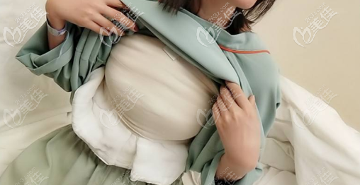 濟南藝星假體隆胸術后第五天 濟南藝星假體隆胸術后第五天