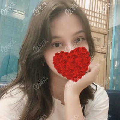 雙眼皮割的又寬又深,找武漢專門修復(fù)雙眼皮的醫(yī)生項(xiàng)利姣做了寬降窄修復(fù),效果自然且價(jià)格便宜