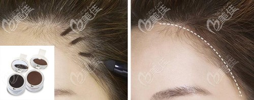 發(fā)際線粉改善發(fā)際線高