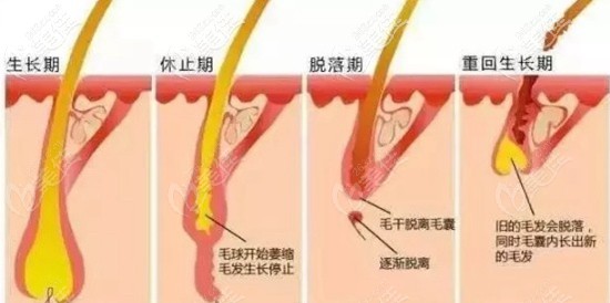 毛發(fā)移植手術(shù)后的脫落期