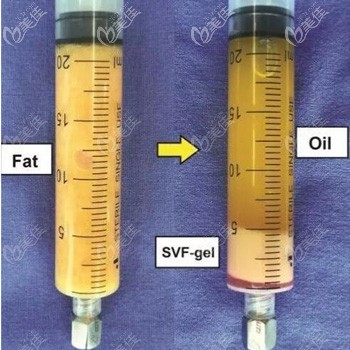 從普通脂肪中提取出的脂肪膠