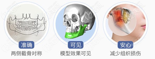 羅金超醫(yī)生做頜面整形手術