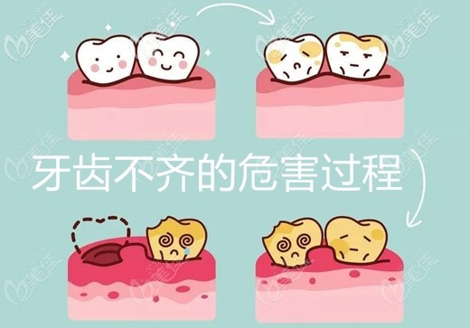 陳明社醫(yī)生淺談牙齒矯正的好處 陳明社醫(yī)生淺談牙齒矯正的好處