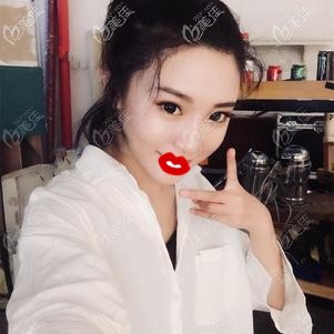 做肋軟骨隆鼻術(shù)后3個(gè)月鼻子恢復(fù)自然