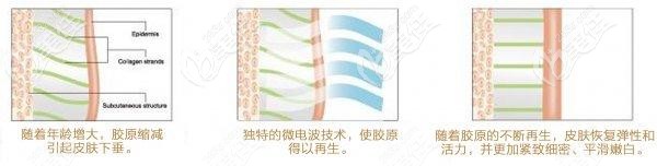 深藍射頻作用層次 深藍射頻作用層次