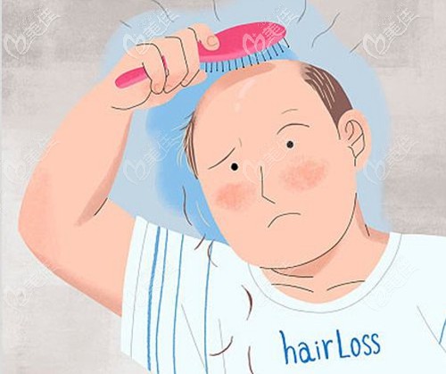 為什么很多人不去植發(fā)