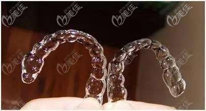 摘掉牙套就要開始佩戴保持器啦 摘掉牙套就要開始佩戴保持器啦