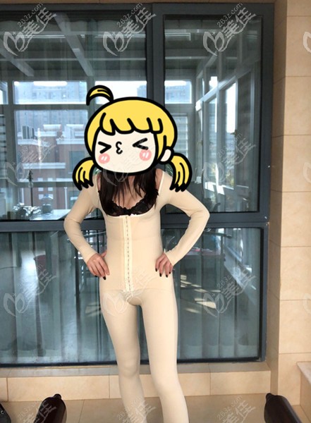 腰腹環(huán)吸術(shù)后1個月穿塑身衣