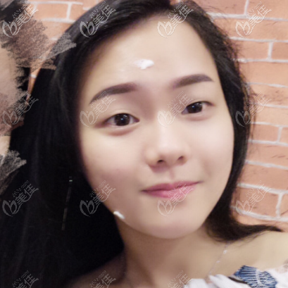 看案例了解廣州軍美<!--<i data=20240703-sp></i>-->醫(yī)生技術(shù)怎么樣 看案例了解廣州軍美<!--<i data=20240703-sp></i>-->醫(yī)生技術(shù)怎么樣