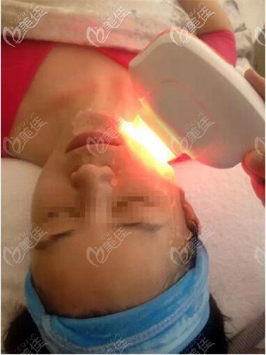 復合彩光嫩膚治療中