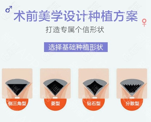 私密種植的種植形狀