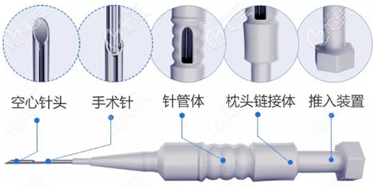 新進(jìn)的微針植發(fā)技術(shù)