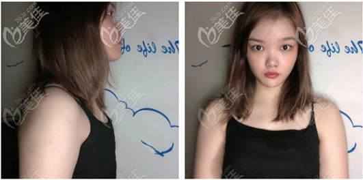 找廣東韓妃牟北平做隆胸術(shù)前照片 找廣東韓妃牟北平做隆胸術(shù)前照片