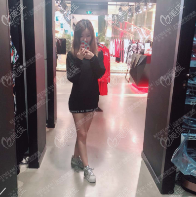 在北京做大腿環(huán)吸好的醫(yī)院做完抽脂后,沒有出現(xiàn)術后硬結等后遺癥