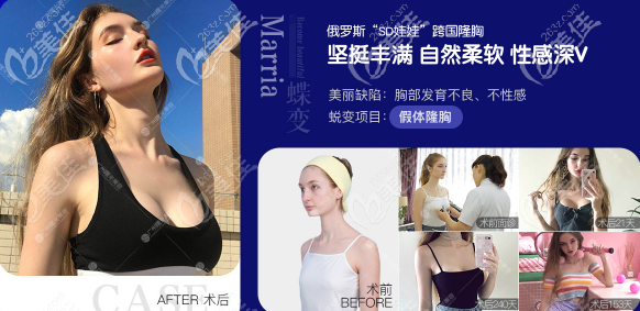 廣州曙光隆胸案例價(jià)格9800元起