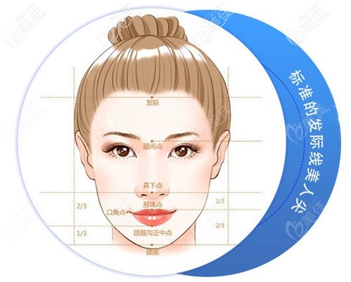 美人尖種植的價格 美人尖種植的價格