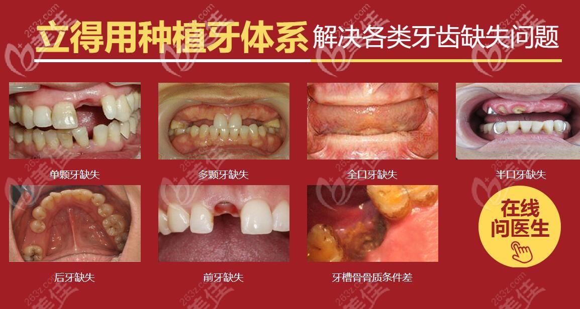 中諾口腔立得用種植牙體系能解決很多牙齒問題 中諾口腔立得用種植牙體系能解決很多牙齒問題