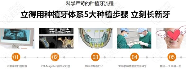 “立得用·種植牙”體系介紹 “立得用·種植牙”體系介紹