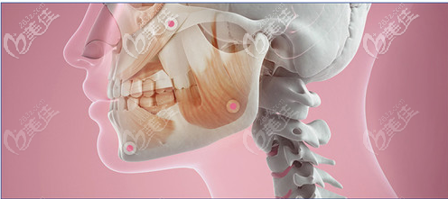 廣州中家醫(yī)家庭醫(yī)生聶云飛下頜角改臉型優(yōu)勢 廣州中家醫(yī)家庭醫(yī)生聶云飛下頜角改臉型優(yōu)勢
