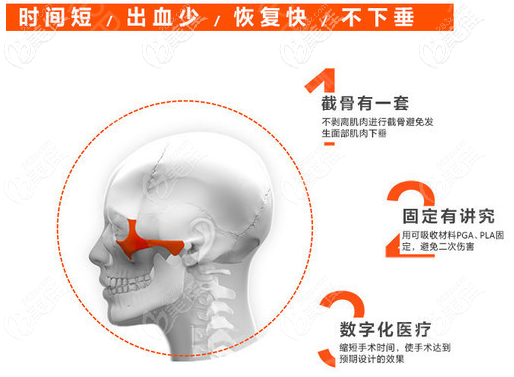 廣州中家醫(yī)家庭醫(yī)生聶云飛磨骨優(yōu)勢(shì)