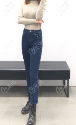 菏澤華美做全身吸脂手術(shù)蠻不錯(cuò)的，讓我成功從140斤逆襲到了110斤