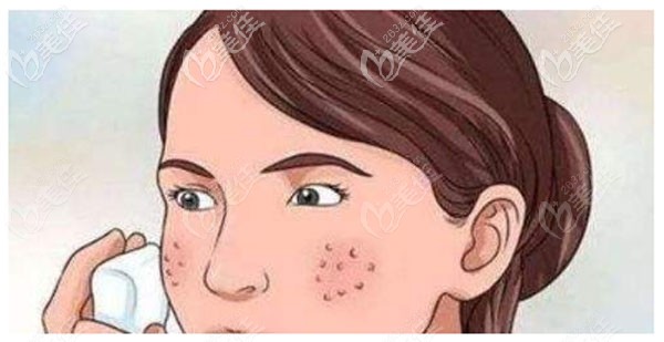 全臉毛孔粗大做納米微晶和微針哪個好