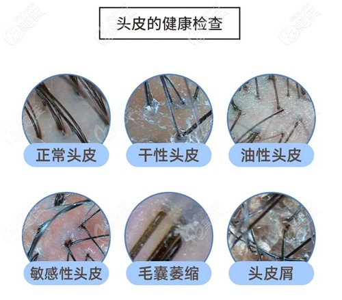 碧蓮盛專業(yè)毛囊檢測(cè)設(shè)備 碧蓮盛專業(yè)毛囊檢測(cè)設(shè)備