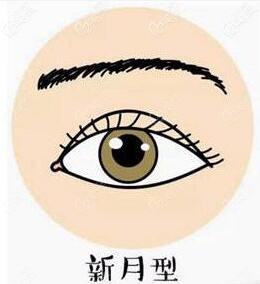 新月型雙眼皮形態(tài) 新月型雙眼皮形態(tài)