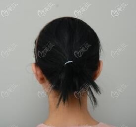 貼發(fā)耳表現(xiàn)是耳朵向后貼頭皮