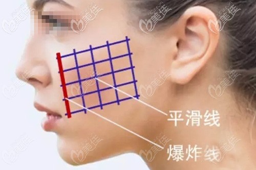 爆炸線填充會和平滑線搭配