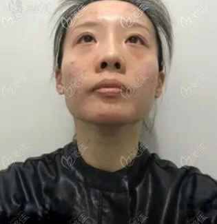 在重慶華美做四代熱瑪吉前 在重慶華美做四代熱瑪吉前