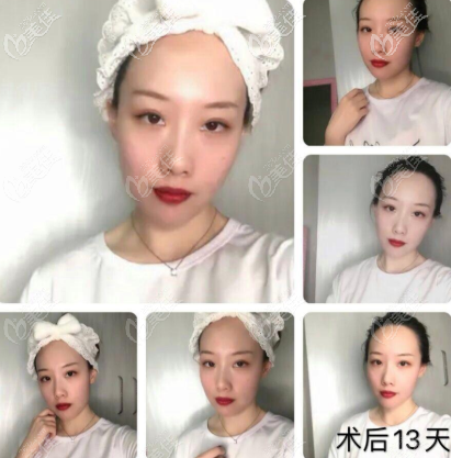 半個月以后 半個月以后