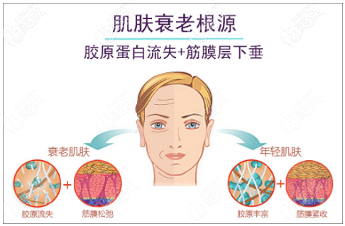 熱瑪吉治療過程