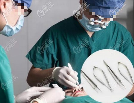 武漢涵美馮曉玲院長雙眼皮手術(shù)過程中 武漢涵美馮曉玲院長雙眼皮手術(shù)過程中