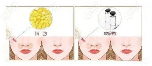 采用其他方式填充鼻基底