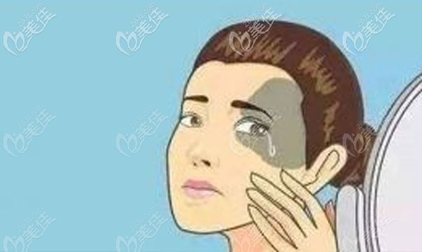 激光去除太田痣多少錢一次