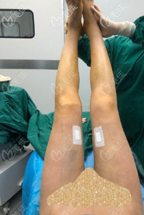 羅<!--<i data=20240703-sp></i>-->醫(yī)生剛給我做完手術(shù)